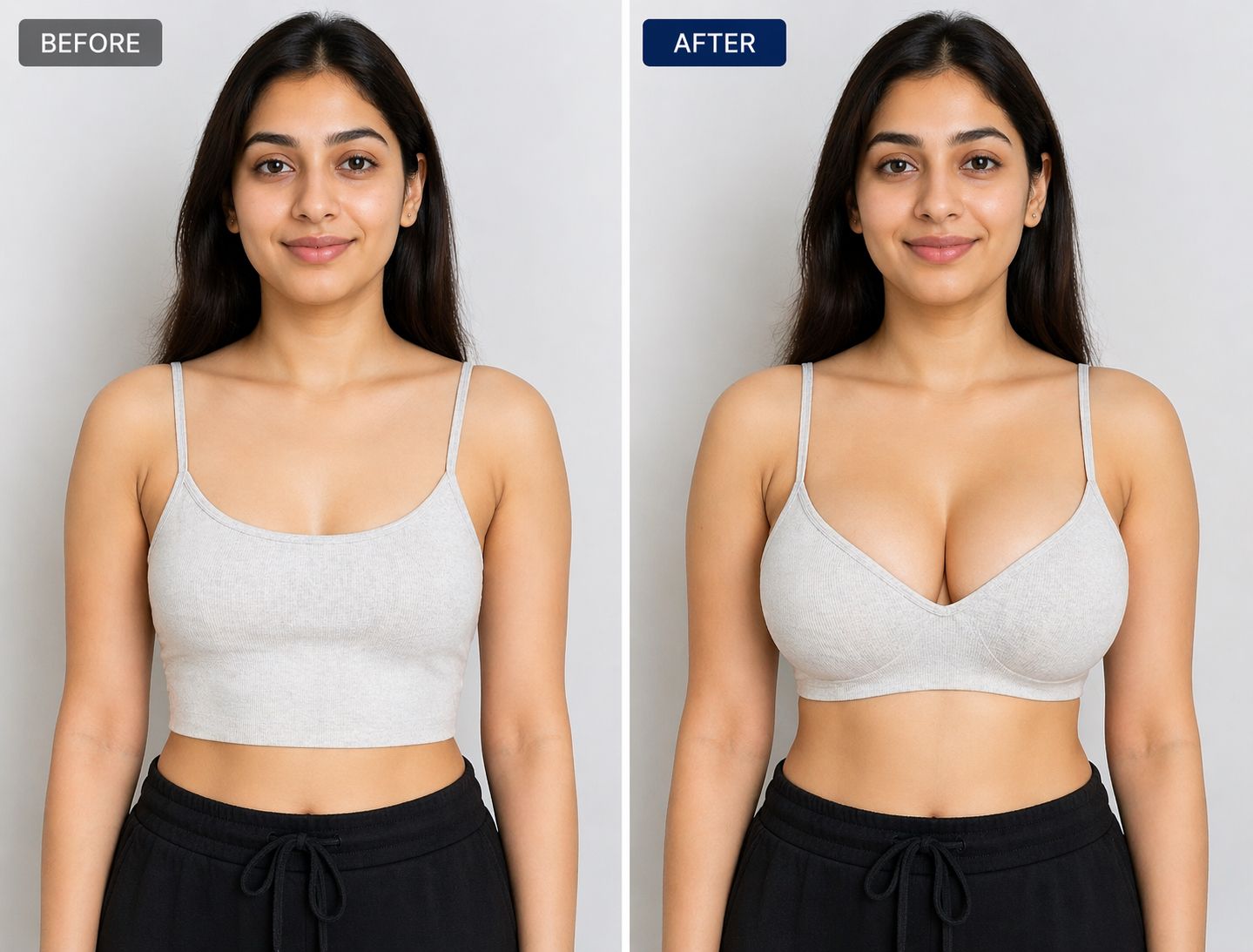 Breast Implant · Gurgaon · Delhi NCR - TRUE Hospitals Gurgaon