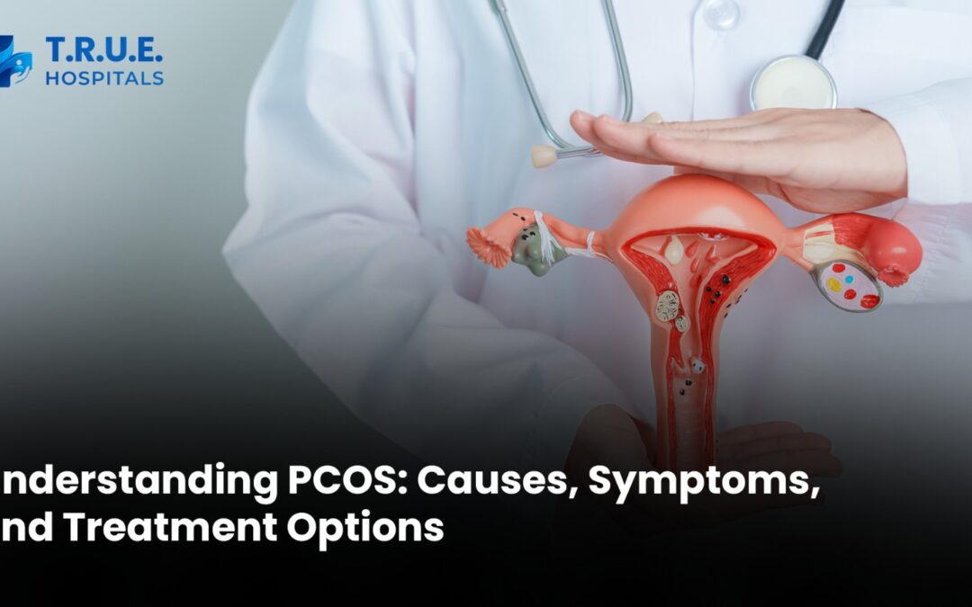 Understanding PCOS: Causes, Symptoms, and Treatment Options