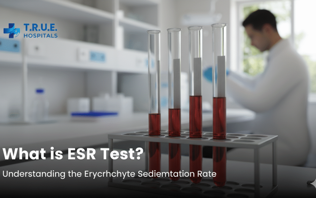 What is ESR Test? ESR Normal Range And Reasons For High ESR Levels