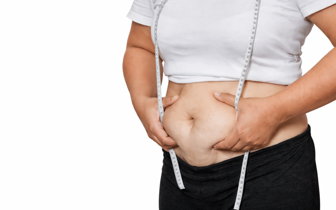 tummy tuck treatment