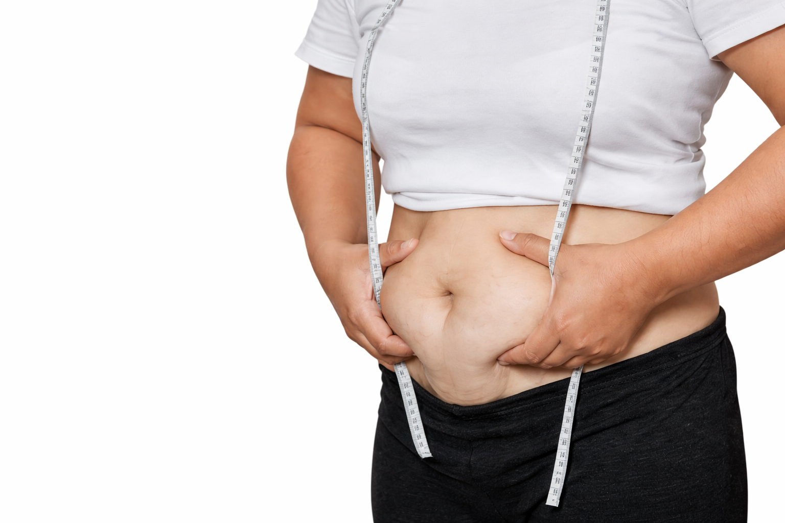 Who Needs Tummy Tuck Surgery?