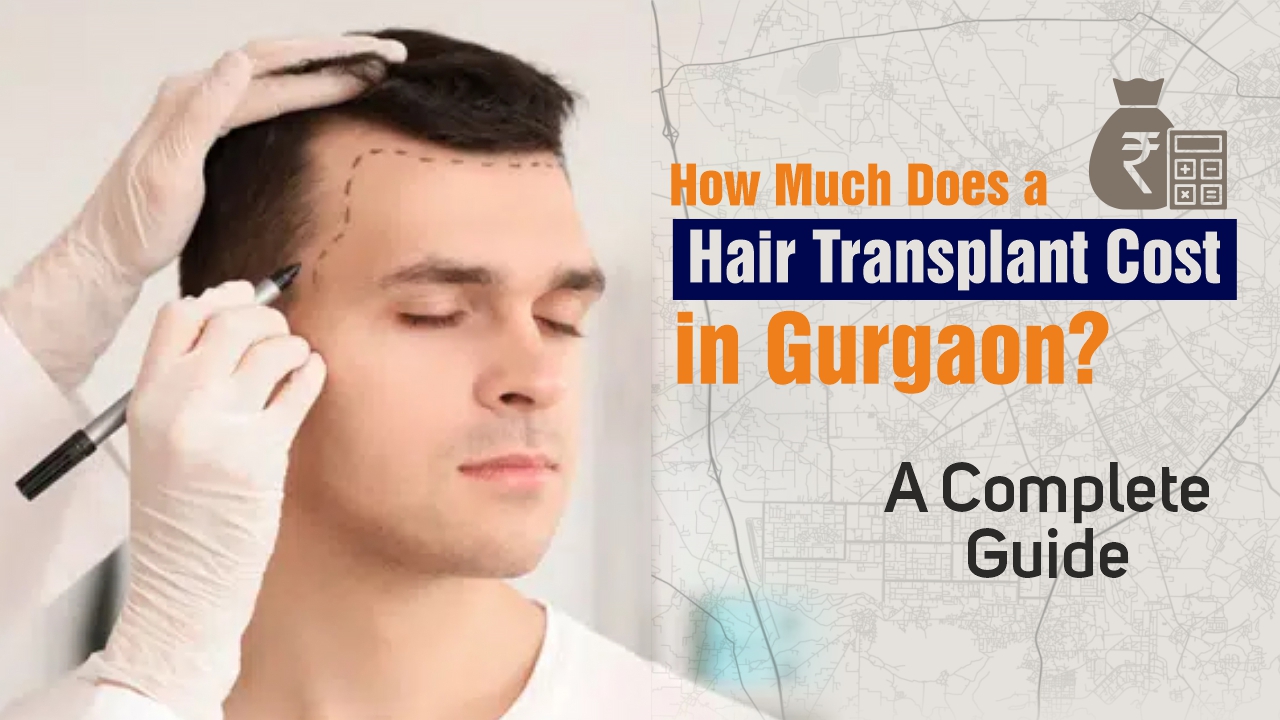 Best Hair Transplant in Gurgaon: Cost, Procedure, Recovery & Results
